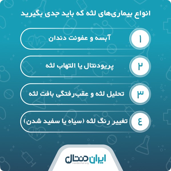 ویژگی بهترین دکتر لثه در زعفرانیه