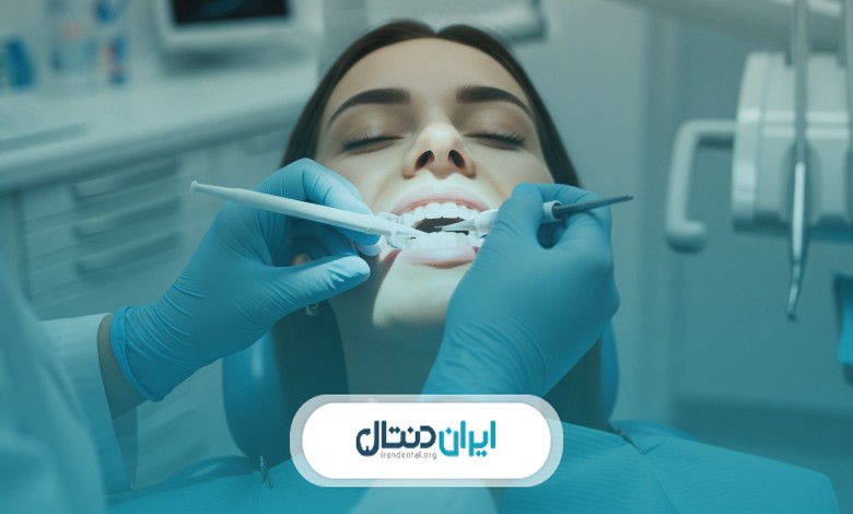  بهترین دکتر بلیچینگ در مشهد 