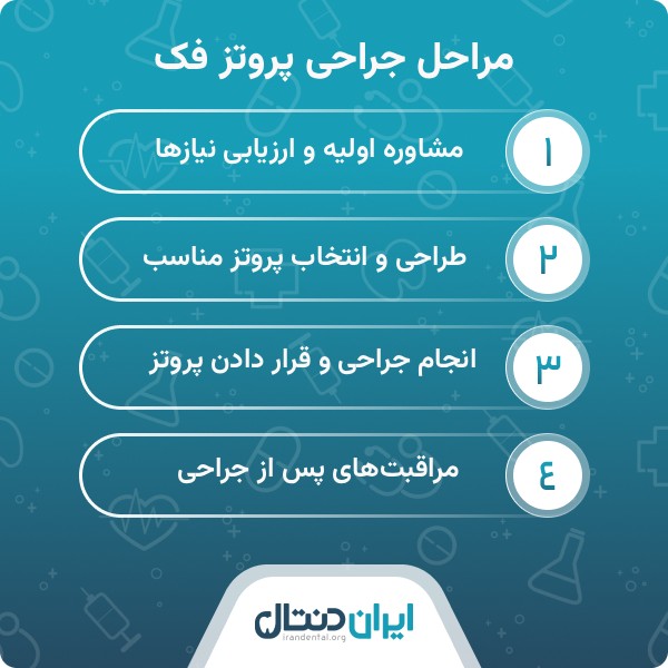 ویژگی بهترین دکتر پروتز فک در زعفرانیه