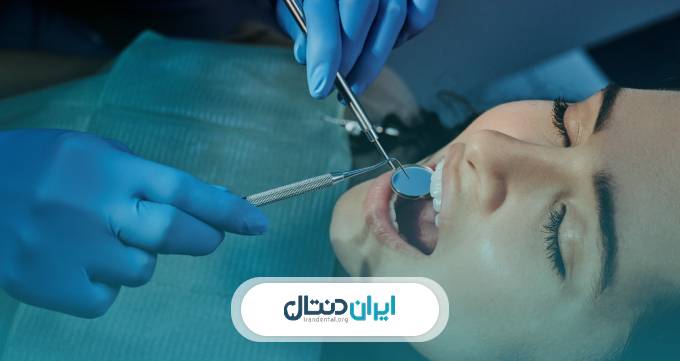 هزینه کامپوزیت دندان در تهران 