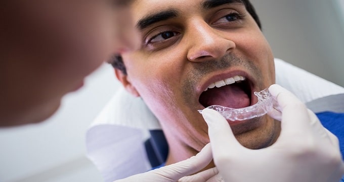 مراقبت های بعد از پروتز دندان