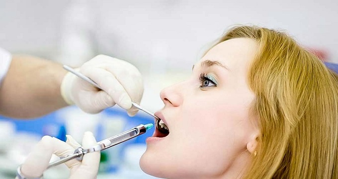 مراحل جراحی دندان عقل