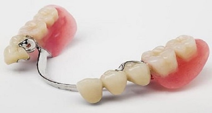 تفاوت بین دندانپزشک و متخصص پروتز دندانی