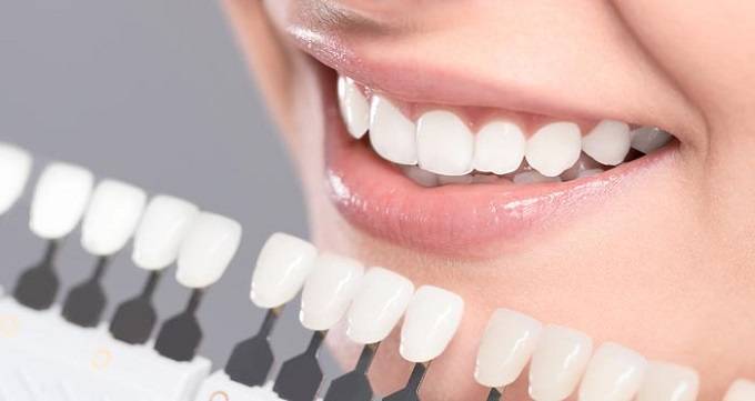 طول عمر کامپوزیت دندان چقدر است؟
