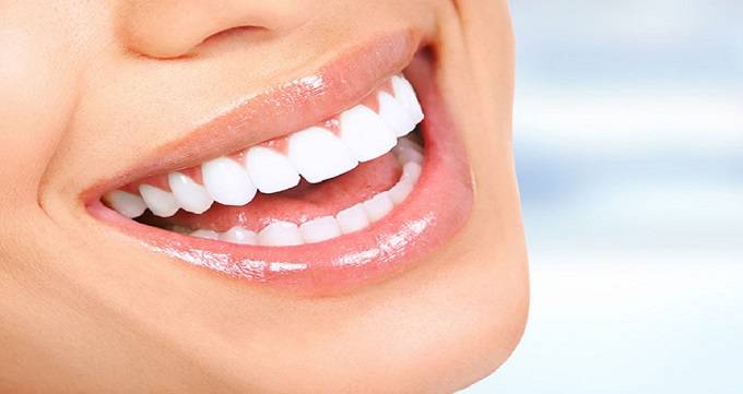 8 نکات مراقبتی بعد از بلیچینگ دندان
