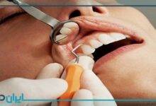 بهترین دندانپزشک درمان ریشه در نیاوران