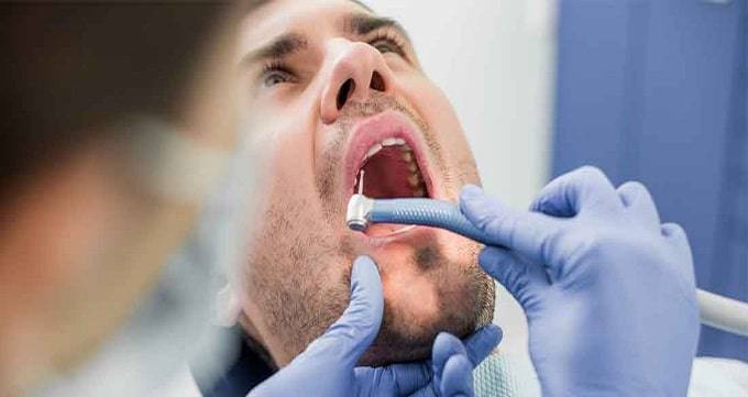 عوامل موثر در هزینه جراحی دندان