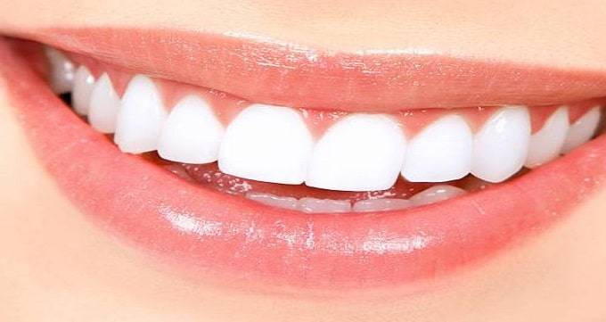 معایب عصب کشی دندان