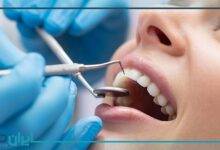 بهترین دندانپزشک درمان ریشه در اصفهان