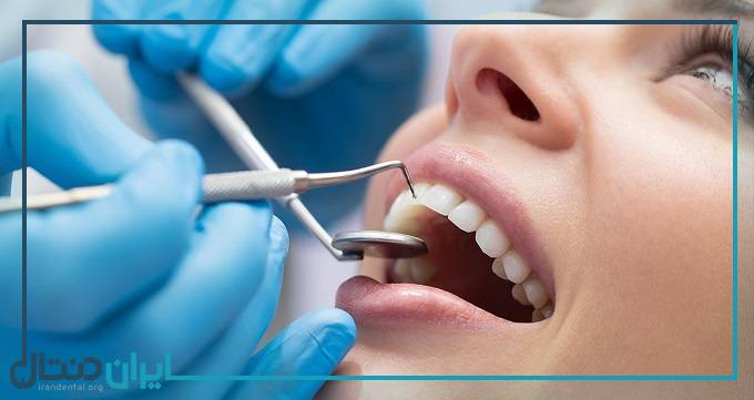 بهترین دندانپزشک درمان ریشه در اصفهان