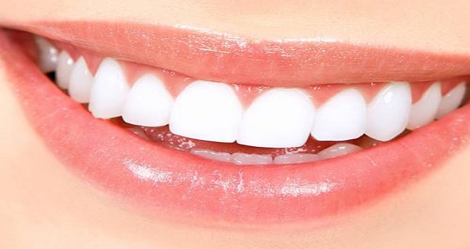 مزایای انجام کامپوزیت دندان