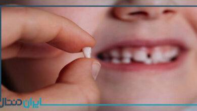 آیا دندان شیری عصب دارد؟