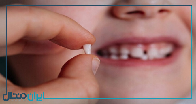 آیا دندان شیری عصب دارد؟