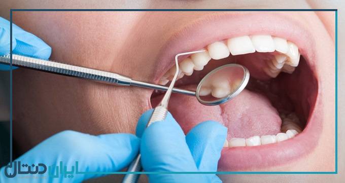 بهترین دندانپزشک درمان ریشه در ایران