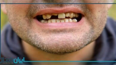 تاثیرات مخرب اعتیاد بر دندان ها
