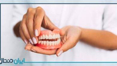 تفاوت ها و شباهت های ایمپلنت و دندان طبیعی