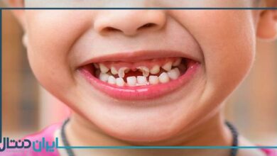 آیا قطره ی آهن سبب پوسیدگی دندان کودکان می شود؟