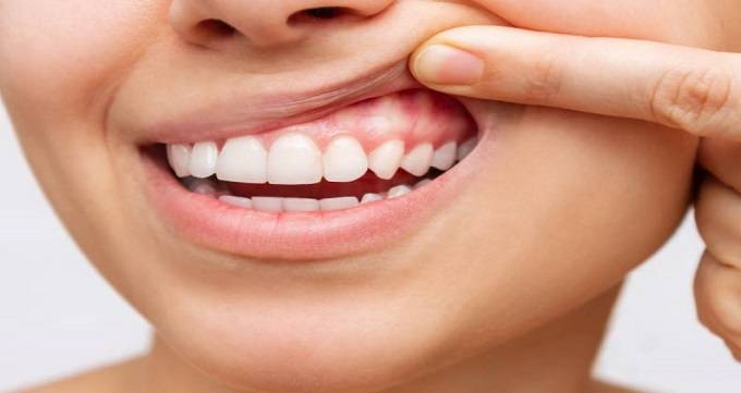 بیماری های دهان و دندان چیست؟