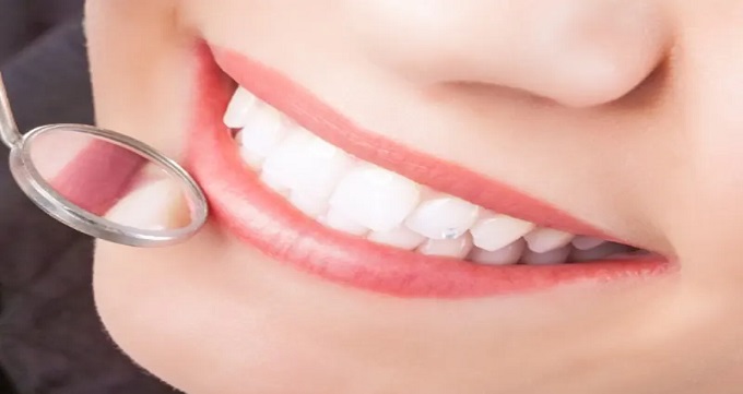 اقدامات لازم برای انجام کامپوزیت دندان
