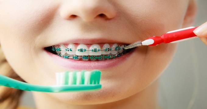 ارتودنسی دندان با چه هدفی انجام می شود؟