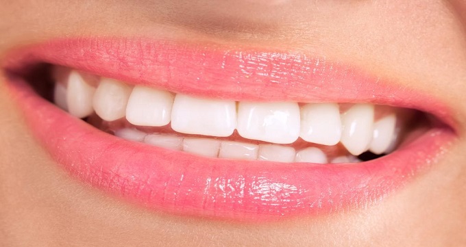 اقدامات لازم برای پیشگیری از تشکیل پلاک دندان