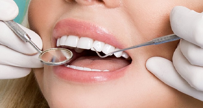 توصیه های بعد از انجام لمینت دندان