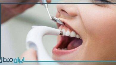 آیا لق شدن دندان بعد از جرم گیری اتفاق می افتد؟