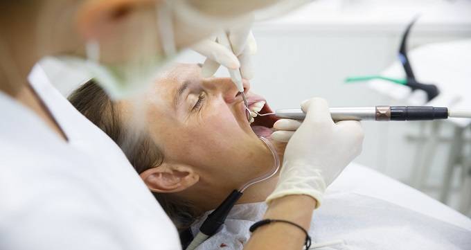 جرم گیری دندان چگونه است؟