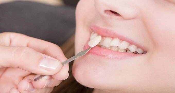 راه های خانگی برای سفید کردن دندان