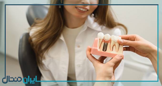عوامل تاثیر گذار در هزینه ایمپلنت دندان
