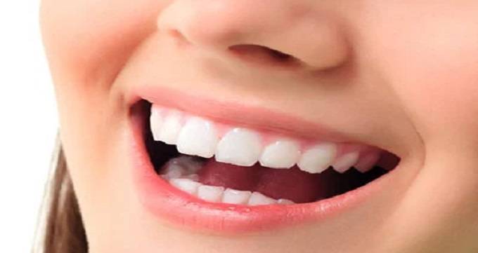 بلیچینگ دندان برای داشتن دندان های زیبا