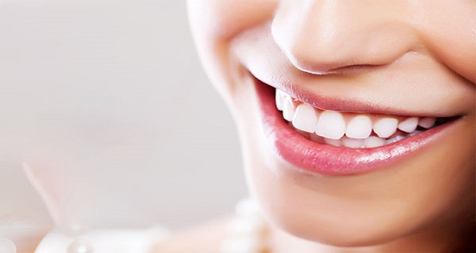 مزایای انجام ایمپلنت دندان