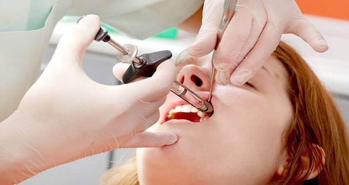 آیا عصب کشی دندان درد دارد؟