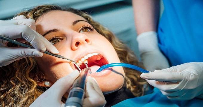چرا عصب کشی به‌ موقع دندان اهمیت دارد؟