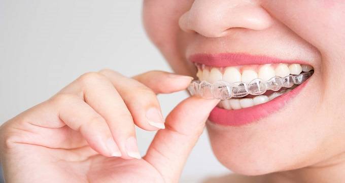  بهترین روش ارتودنسی دندان