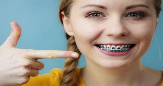 مزایا و توصیه های ارتودنسی دندان