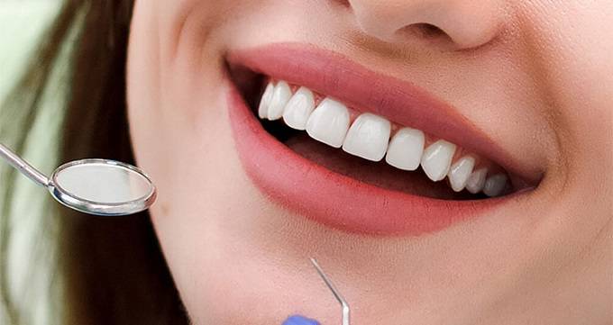 10 تفاوت کامپوزیت و لمینت دندان را بدانید