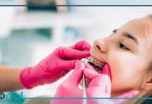 بهترین دکتر ارتودنسی در مازندران