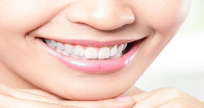 ایا جرمگیری دندان ها را سفید می کند؟