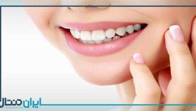 سفید کردن دندان ها با 13 روش خانگی و ارزان