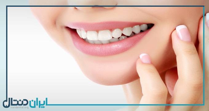 سفید کردن دندان ها با 13 روش خانگی و ارزان