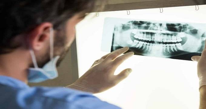 رادیوگرافی دندان چیست؟