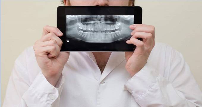 مزایای رادیوگرافی دندان
