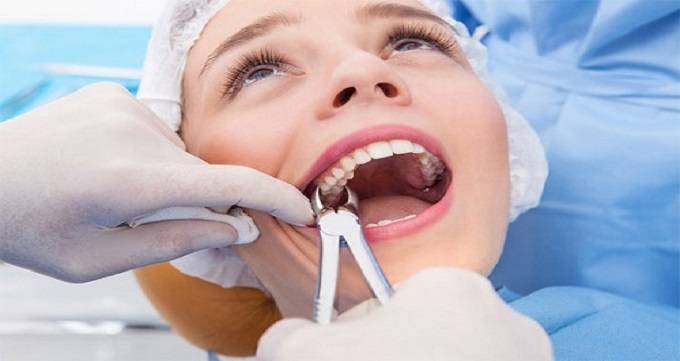 کشیدن دندان چیست؟