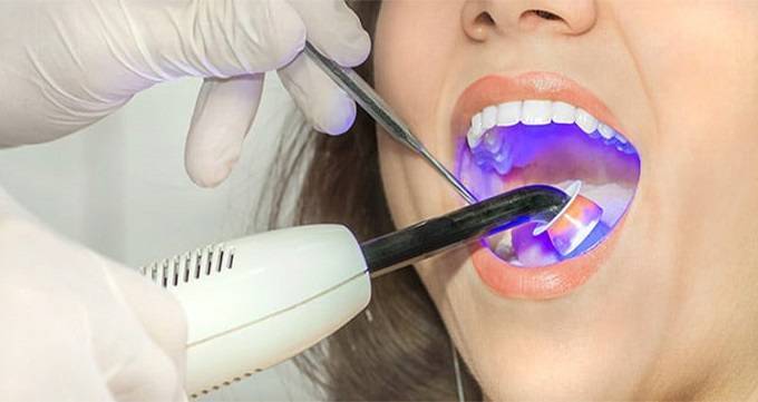 دندانپزشکی با لیزر چیست؟