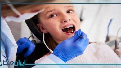 آیا ارتودنسی دندان محدودیت سنی دارد؟