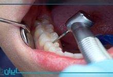 بهترین دندانپزشک درمان ریشه در مازندران
