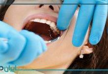 5 روش برای تشخیص عفونت دندان