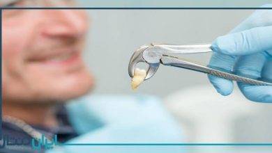 فاصله زمانی مناسب بین کشیدن دندان تا ایمپلنت گذاری چقدر است؟