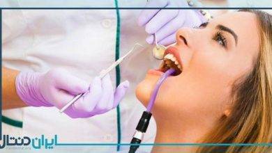 روش های جایگزین درمان ریشه دندان